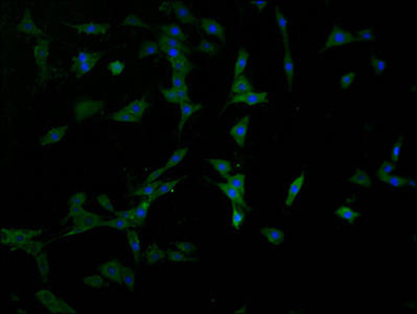 PPT2 Antibody (PACO64483)