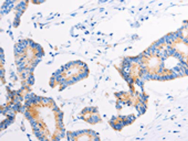 AGTR2 Antibody (PACO18559)