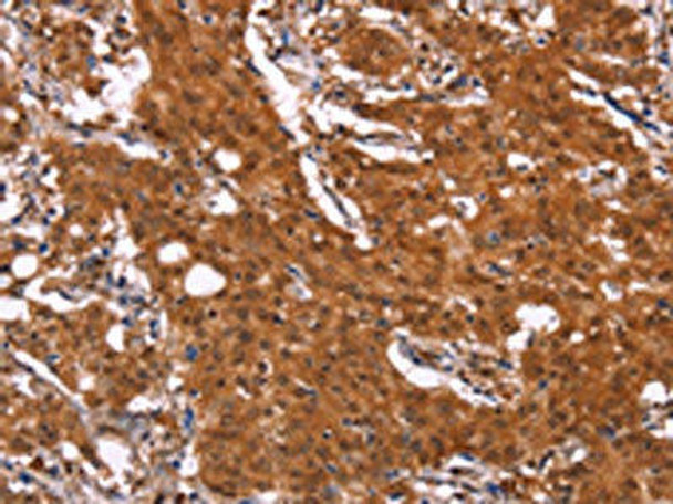 APMAP Antibody (PACO18574)