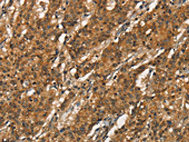 APOC4 Antibody (PACO18578)