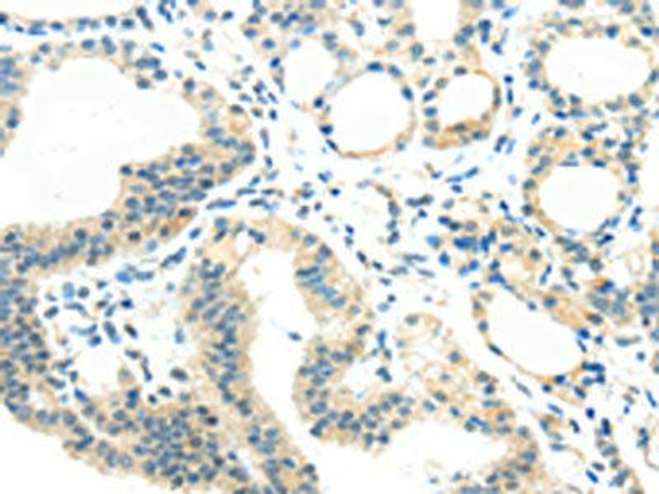 AEBP1 Antibody (PACO18648)