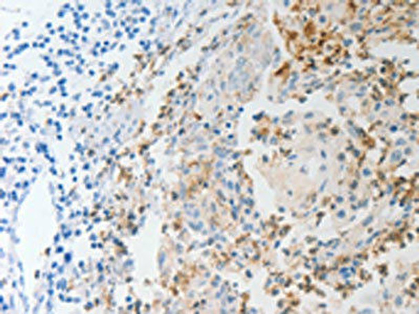 NFKB2 Antibody (PACO18744)