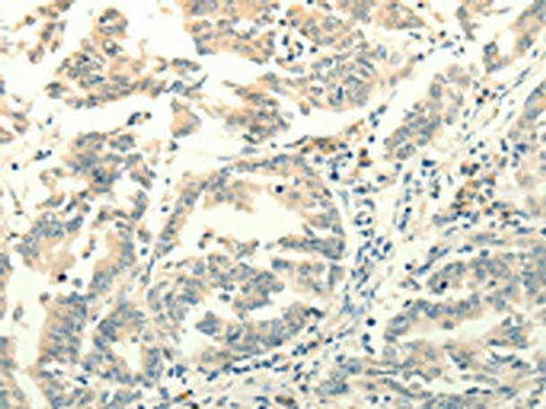 FZD8 Antibody (PACO19022)