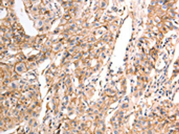 CDH1 Antibody (PACO19030)