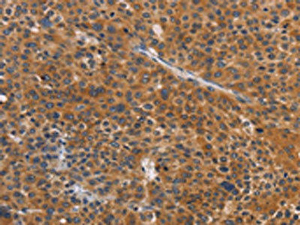 NCR1 Antibody (PACO19414)