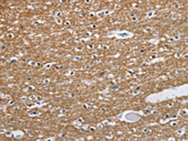 NCR2 Antibody (PACO19416)