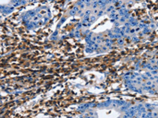 PTPRC Antibody (PACO19427)