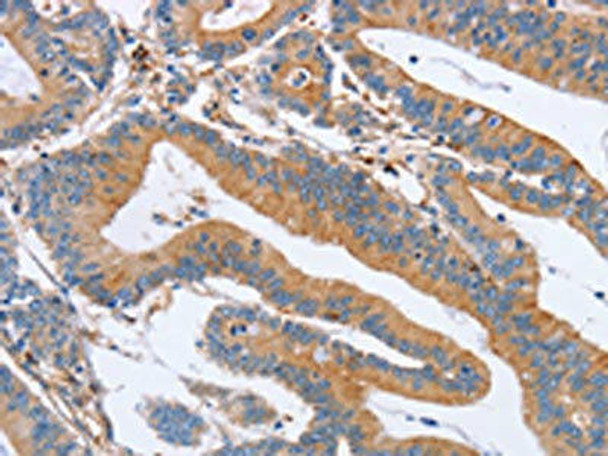 CDC7 Antibody (PACO19452)