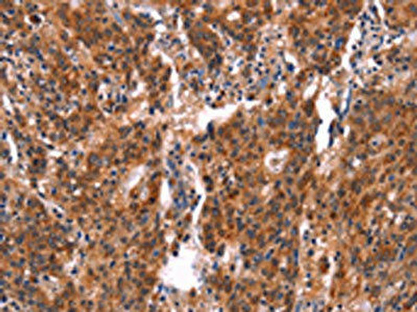 FEM1A Antibody (PACO19654)