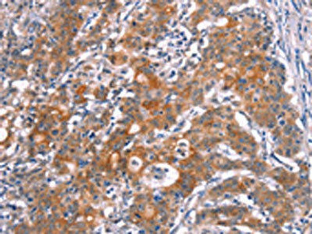 SLC6A1 Antibody (PACO19684)