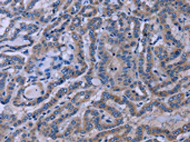 TUBGCP2 Antibody (PACO19698)