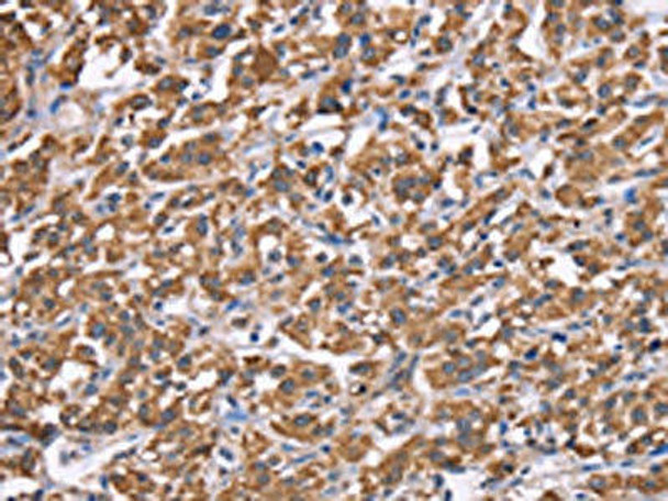 HSPE1 Antibody (PACO19798)