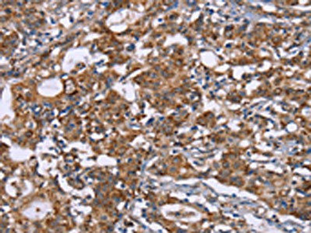 HSPE1 Antibody (PACO19799)