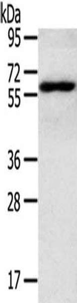 RORA Antibody (PACO20364)
