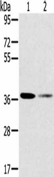 SMN1 Antibody (PACO20557)