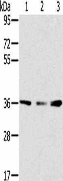 SMN1 Antibody (PACO20558)