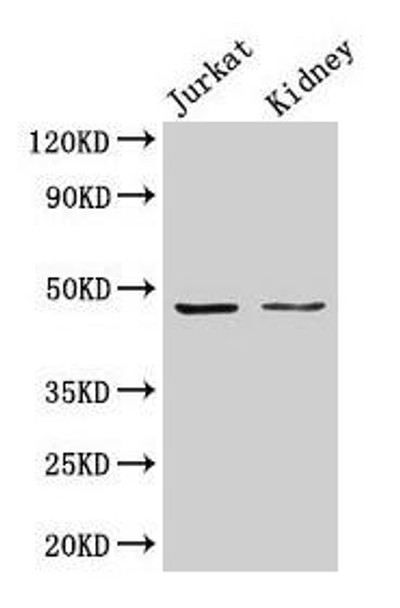 ALDOA Antibody (PACO24616)