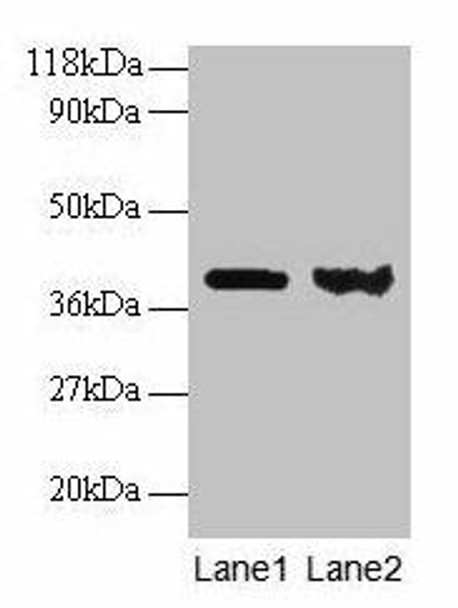 ARHGDIA Antibody (PACO24664)
