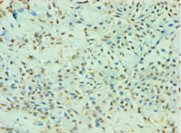 TDP1 Antibody (PACO43571)