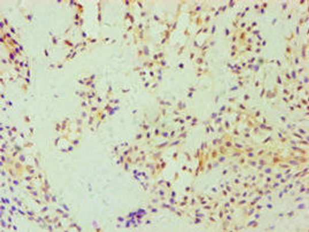 GSDME Antibody (PACO43576)