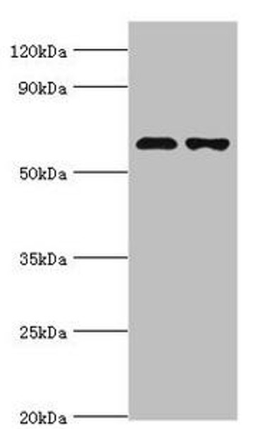 SOAT1 Antibody (PACO43585)