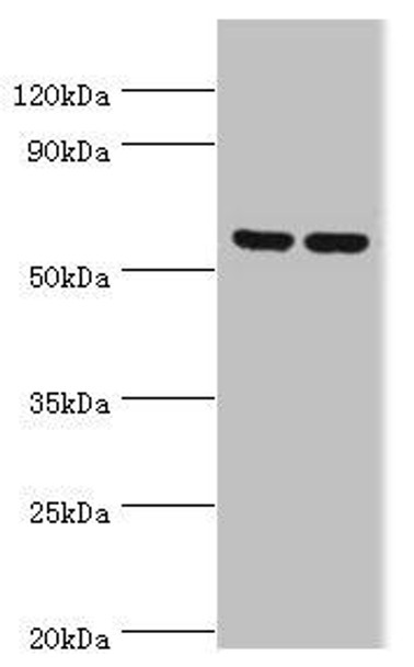 PRKAG3 Antibody (PACO43612)