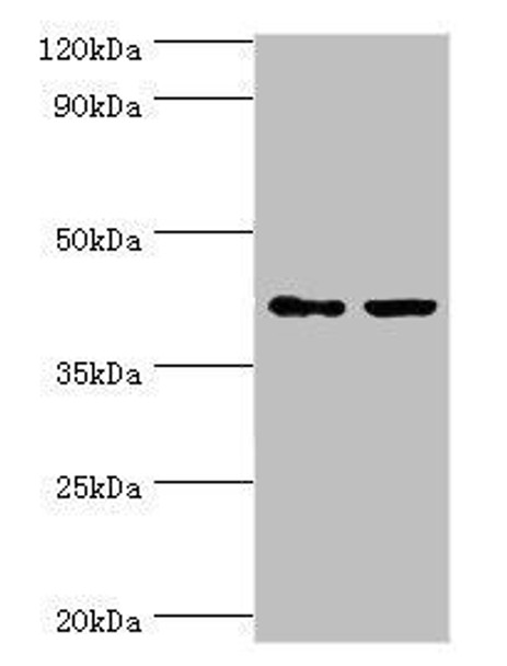 GTF2H2C Antibody (PACO43868)