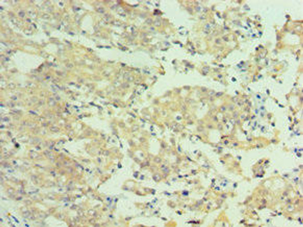 MTMR4 Antibody (PACO44119)