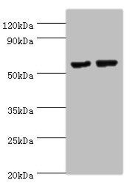 MATN3 Antibody (PACO44150)