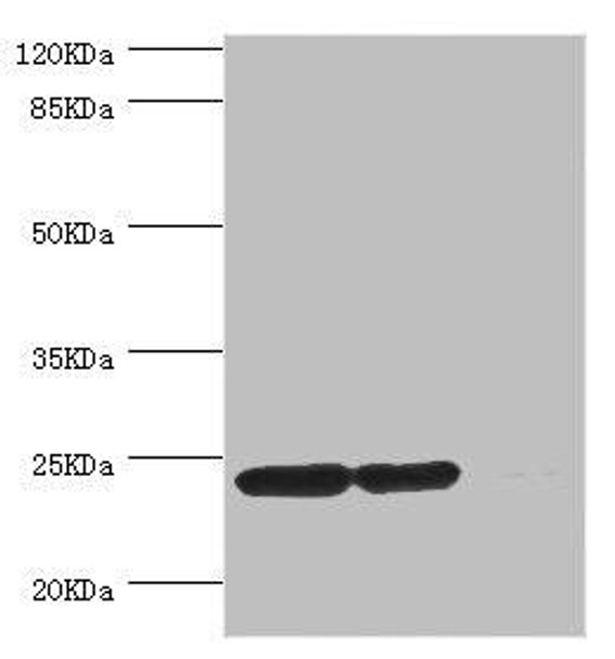 DTYMK Antibody (PACO44261)