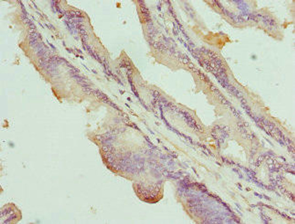 NOX5 Antibody (PACO44432)