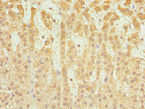 CAPNS1 Antibody (PACO44435)