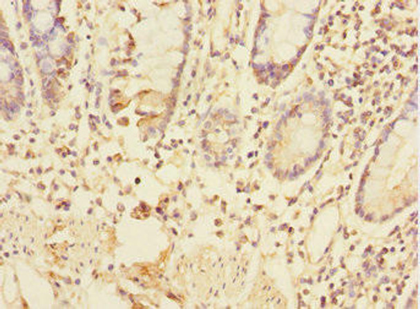 TRIAP1 Antibody (PACO44556)