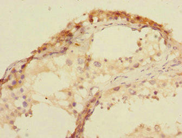 U2AF1L4 Antibody (PACO44565)