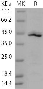 Human IDO1/IDO Recombinant Protein (Gly&Ala2-Gly403) (Active) (RPES1162)
