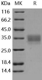 Human CD147/Basigin Recombinant Protein (RPES5181)