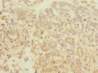 Tigd TIGD7 Antibody (PACO37006)