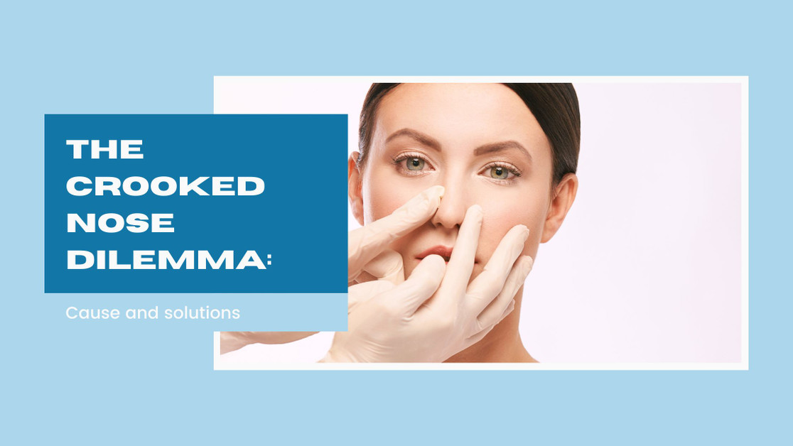 Nose Inserts to Change Shape of a Crooked Nose: Causes, Genetic Components, Defective Surgeries, and the nose insert option
