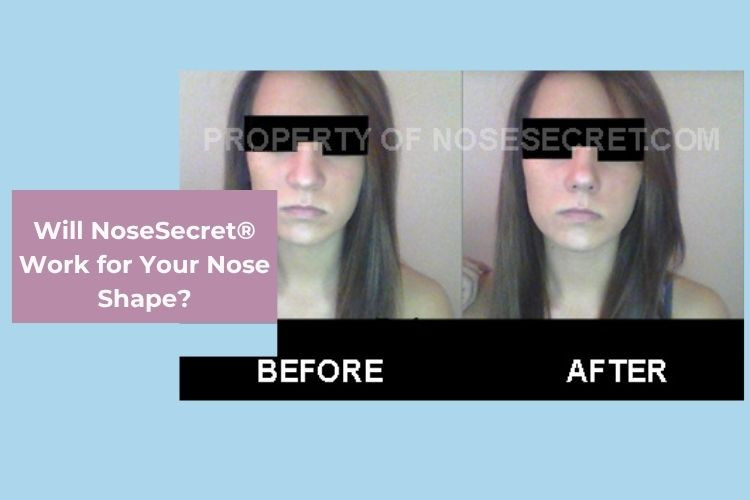 Will NoseSecret® Work for Your Nose Shape?
