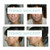 Model using NoseSecret® M, L, XL kit – discreet nose lift tool designed for wider or stronger fit needs Model using NoseSecret® M, L, XL kit – discreet nose lift tool designed for wider or stronger fit needs