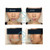 Model showing natural enhancement with NoseSecret® XS, S, M kit – discreet nose lift for beginners Model showing natural enhancement with NoseSecret® XS, S, M kit – discreet nose lift for beginners