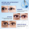 Under Eye Bags and Lines | 50% off Two for $49.99  Advanced Formula | Buy 1 get 1 FREE 10 ml