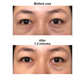 Eye Bag Reduction Cream | Smooth and Reduce Inflammation | Tegoder  20ml