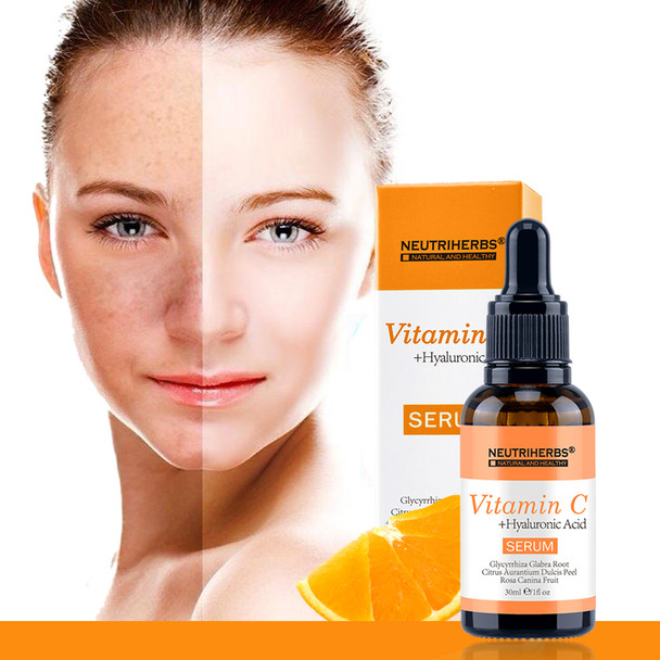 Vitamin C Serum for Face, Topical Facial Serum with
