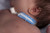 Tracheostomy Tube Holder Dale