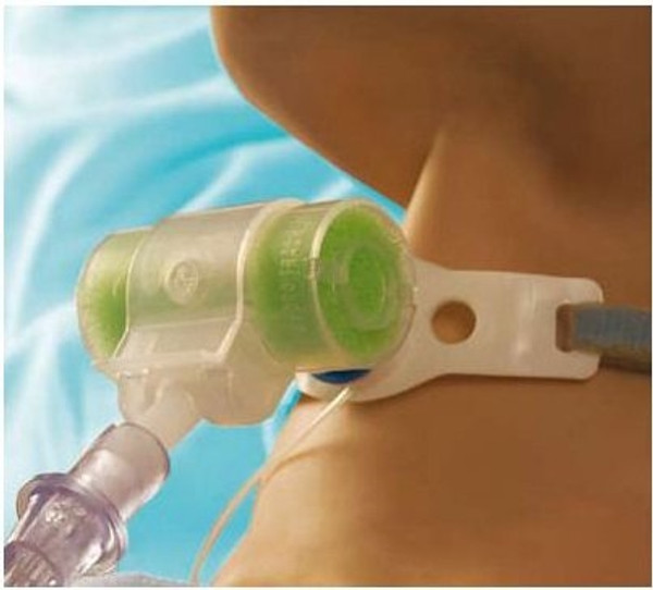 Tracheostomy Tube Hydro-Trach T Mk II HME