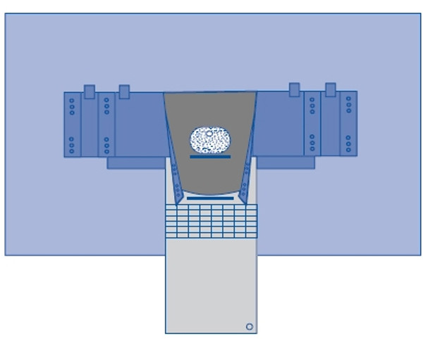 Nephroscopy Surgical Drape