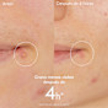 Caudalie Vinopure Spot Solution Face Cream - 6900494
