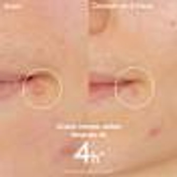 Caudalie Spot Solution Vinopure 15ml - 6900494