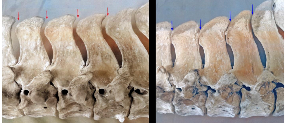 Side view of vertebrae T12-T15 from two horses. 